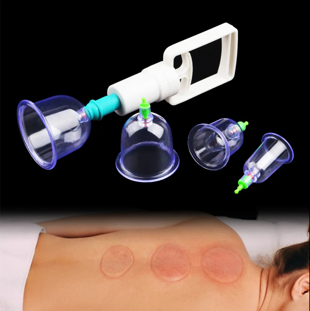 6-Piece Vacuum Cupping Set with Pumping Gun
