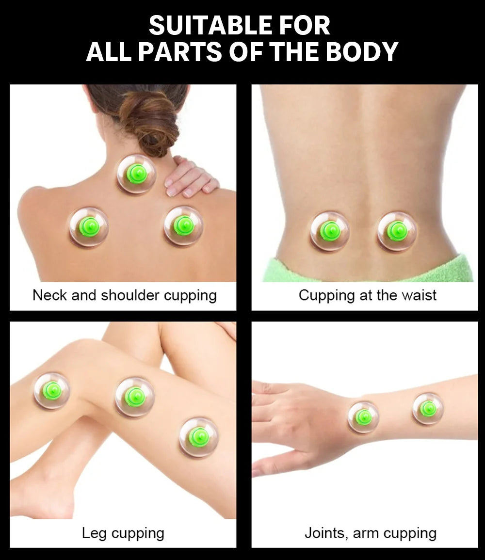 6-Piece Vacuum Cupping Set with Pumping Gun